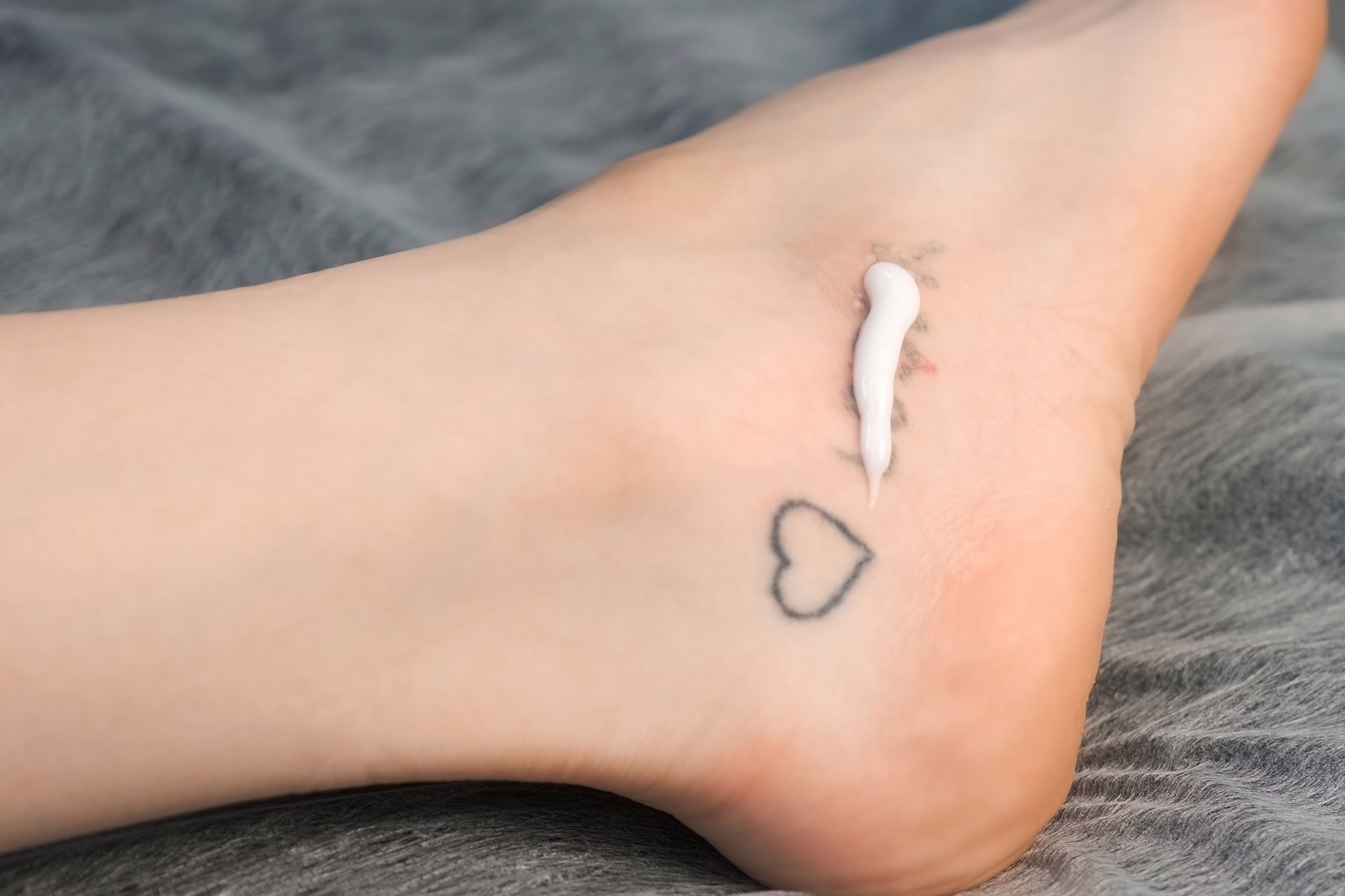 Laser Tattoo Removal Reno, NV – Lake Tahoe, NV – Murphy Plastic Surgery & Medical Spa