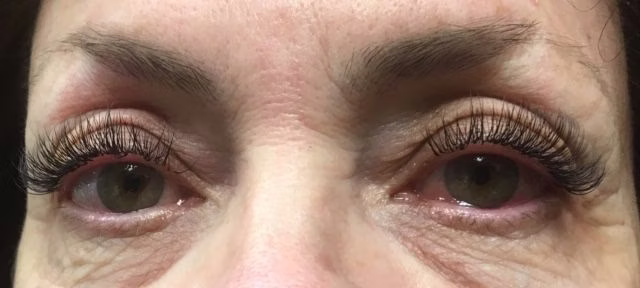 Eyelash Extensions Reno, NV – Lake Tahoe, NV – Murphy Plastic Surgery & Medical Spa