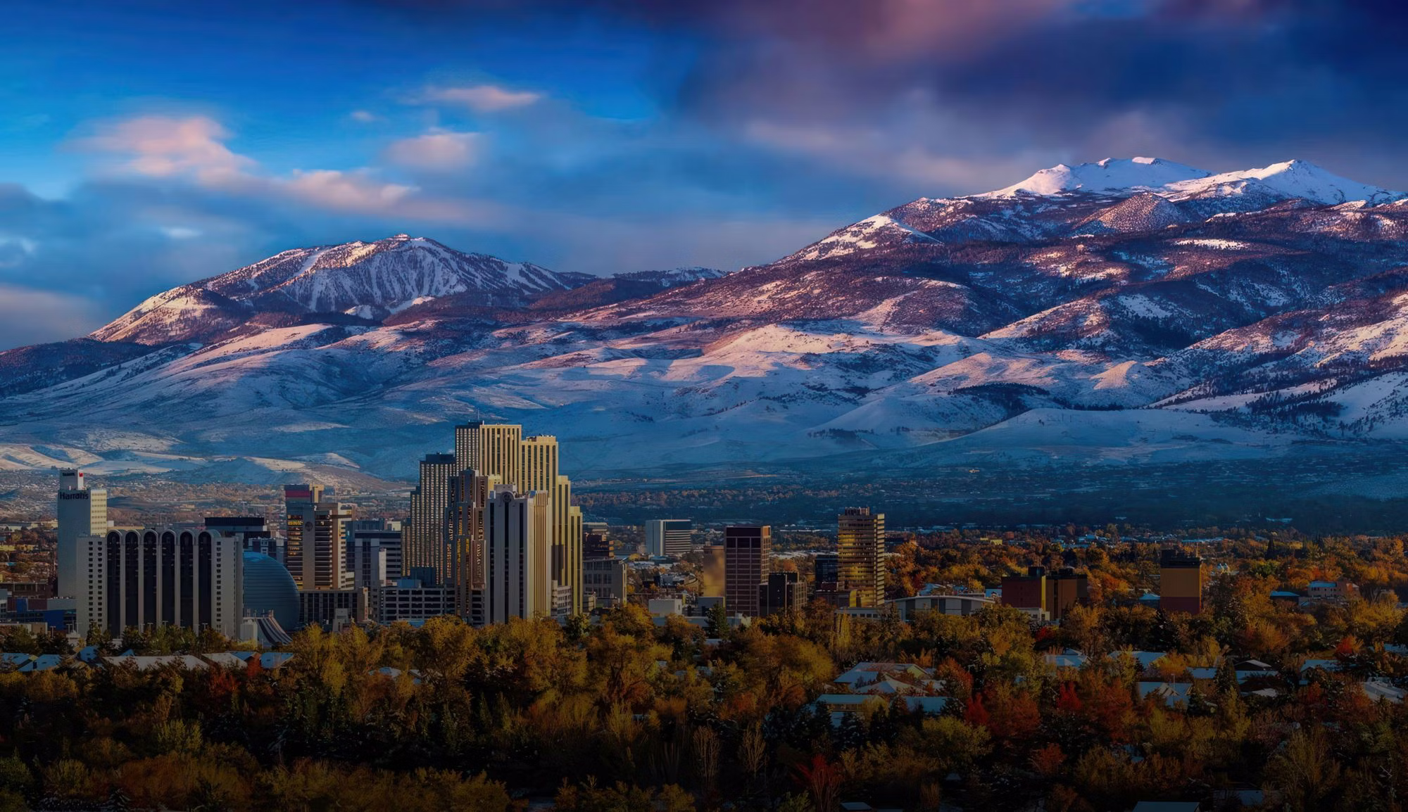 Laser Hair Removal in Reno, NV | Elite iQ™ Laser