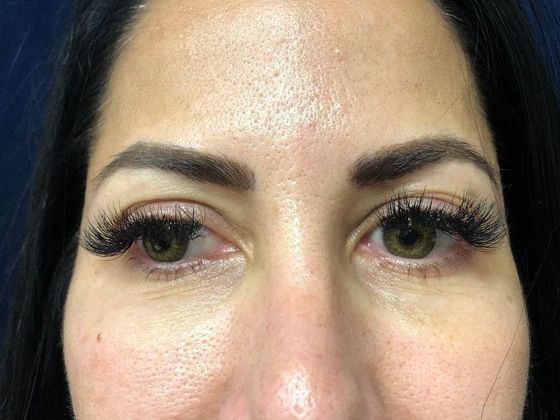 PDO Threads: Case 4 - Before