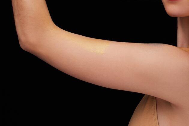 Arm Lift*/Arm Sculpting