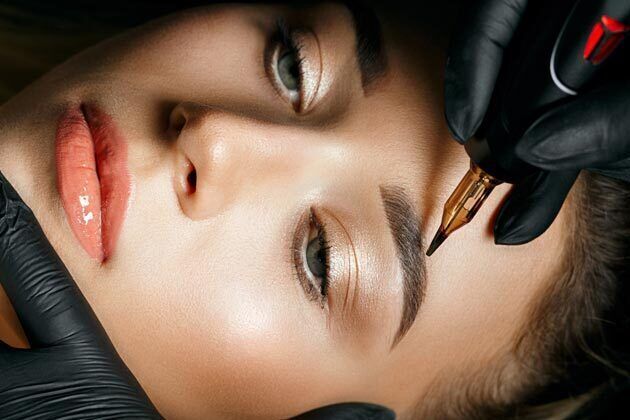 Potenza RF Microneedling