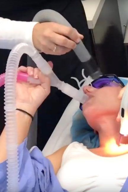 CO2 Laser Skin Treatment – Reno, NV – Murphy Plastic Surgery & Medical Spa