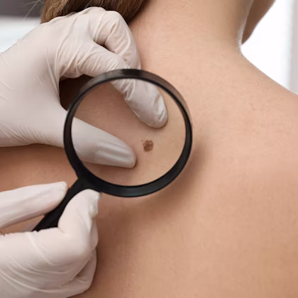 PicoSure Reno, NV – Lake Tahoe, NV – Murphy Plastic Surgery & Medical Spa