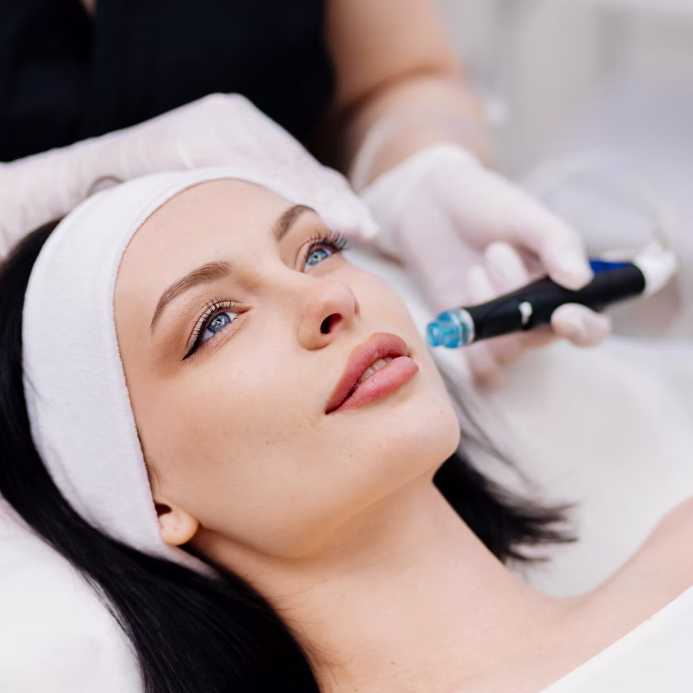 Microneedling in Reno, NV | Potenza RF & SkinPen