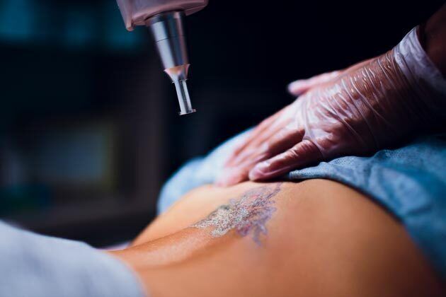 Cosmetic Tattooing